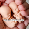 Abortion Available States
